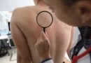 Šta znače mladeži na vašem licu? Kinesko tumačenje otkriva važne poruke o karakteru i sudbini