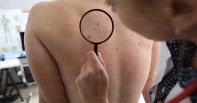 Šta znače mladeži na vašem licu? Kinesko tumačenje otkriva važne poruke o karakteru i sudbini