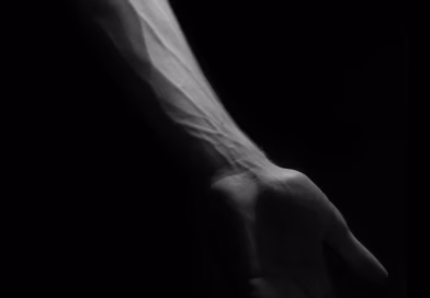 Bol u venama na rukama: mogući uzroci, simptomi i kada potražiti stručni savet Bol u venama na rukama: mogući uzroci, simptomi i kada potražiti stručni savet