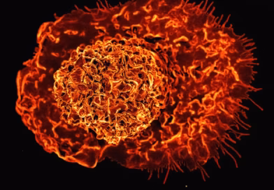 8 namirnica za doručak koje mogu pomoći u smanjenju upalnih procesa u telu