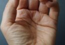 Zašto Vaši Prsti Odjednom Postaju Beli? Moguće Objašnjenje Koje Mnogi Ne Znaju
