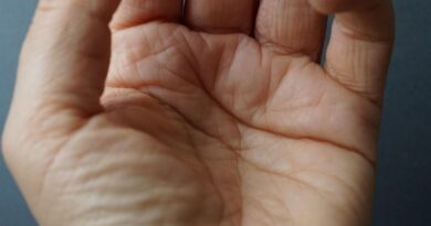 Zašto Vaši Prsti Odjednom Postaju Beli? Moguće Objašnjenje Koje Mnogi Ne Znaju