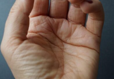 Zašto Vaši Prsti Odjednom Postaju Beli? Moguće Objašnjenje Koje Mnogi Ne Znaju