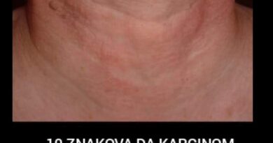 10 ranih znakova koje ne treba ignorisati: Kada tijelo upozorava na ozbiljne probleme