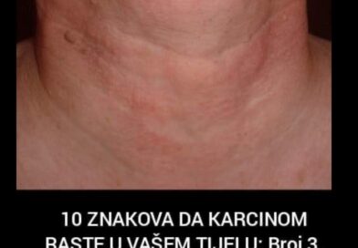 10 ranih znakova koje ne treba ignorisati: Kada tijelo upozorava na ozbiljne probleme