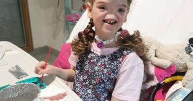 Nevjerovatna životna priča Tese Evans: Djevojčica koja je rođena bez nosa, ali s osmijehom koji je osvojio svijet