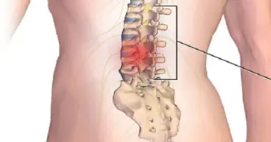 “Zlatno mlijeko” od kurkume: šta je stvarno korisno, a šta pretjerano