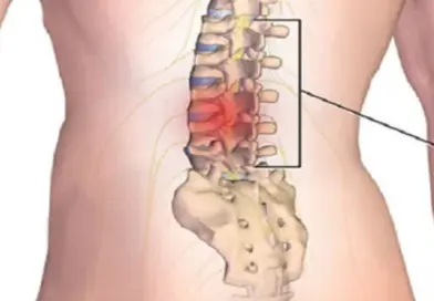 “Zlatno mlijeko” od kurkume: šta je stvarno korisno, a šta pretjerano “Zlatno mlijeko” od kurkume: šta je stvarno korisno, a šta pretjerano