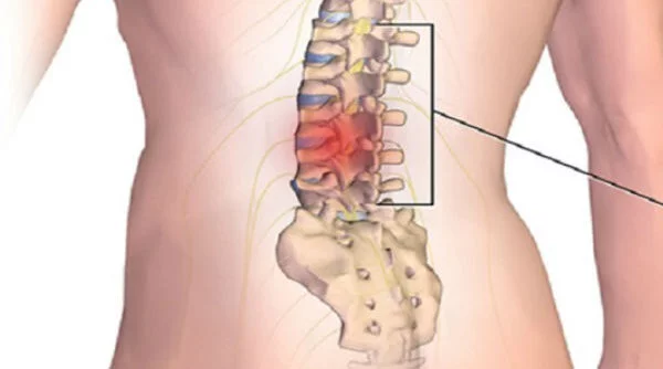 “Zlatno mlijeko” od kurkume: šta je stvarno korisno, a šta pretjerano “Zlatno mlijeko” od kurkume: šta je stvarno korisno, a šta pretjerano