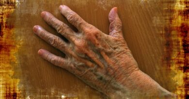 Prirodna njega ruku: Jednostavan način za ublažavanje fleka i znakova starenja