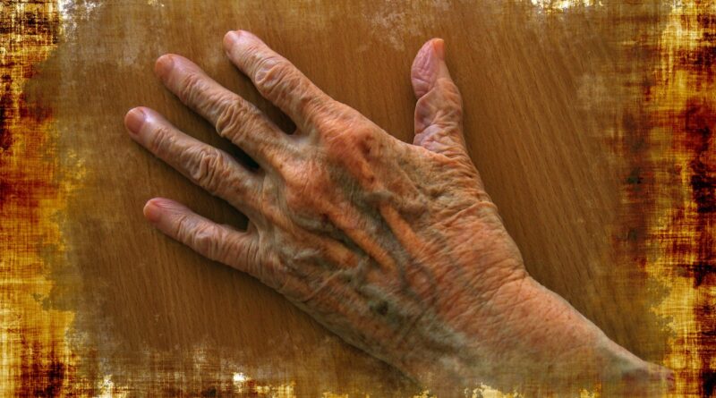 Prirodna njega ruku: Jednostavan način za ublažavanje fleka i znakova starenja Prirodna njega ruku: Jednostavan način za ublažavanje fleka i znakova starenja