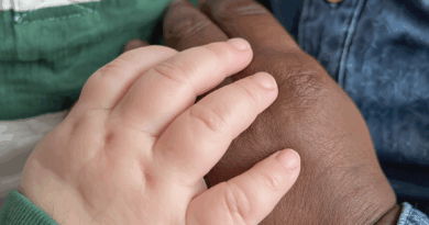 Kad su se rodili blizanci različite boje kože, svi su sumnjali: Istina je bila potpuno drugačija