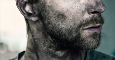 Povratak kući sa protezom i gubitak povjerenja: kako su tri godine promijenile sve