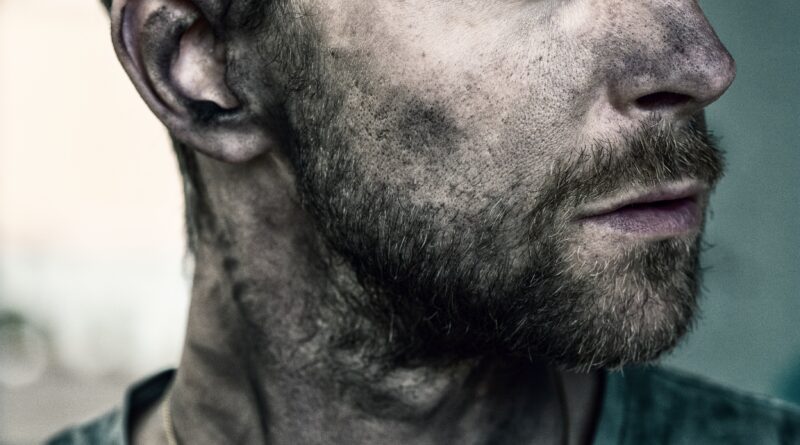 Povratak kući sa protezom i gubitak povjerenja: kako su tri godine promijenile sve