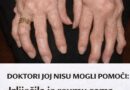 Prirodni načini za ublažavanje reume: Iskustvo žene koja je promijenila svakodnevne navike