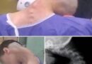 Rijetko stanje vrata kod mladog muškarca privuklo pažnju ljekara: Stručnjaci upozoravaju na važnost ranog reagovanja