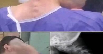 Rijetko stanje vrata kod mladog muškarca privuklo pažnju ljekara: Stručnjaci upozoravaju na važnost ranog reagovanja Rijetko stanje vrata kod mladog muškarca privuklo pažnju ljekara: Stručnjaci upozoravaju na važnost ranog reagovanja