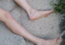 TIHI EMOCIONALNI POSLJEDICE POGREŠNE INTIMNE ODLUKE: ŠTA SE ZAISTA DEŠAVA POSLIJE
